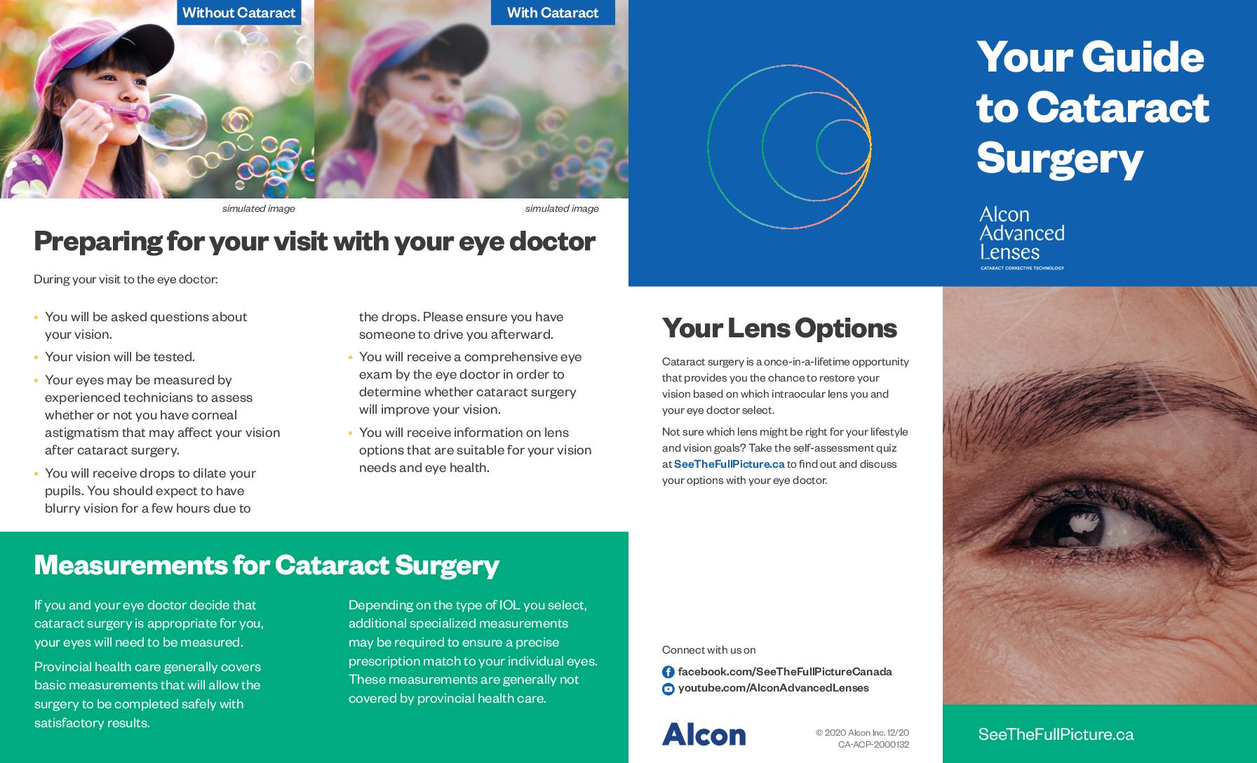 Cataracts Alcon Patient Brochure